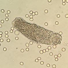 Las mejores 27 ideas de Orinar | hematología, microbiología, análisis ...