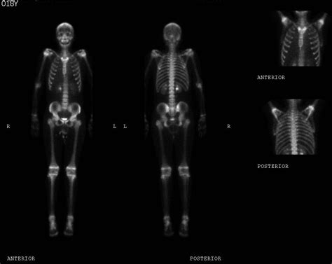 UCSD Musculoskeletal Radiology