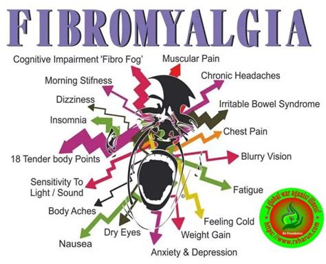 Fibromyalgia, Causes, Symptoms, Diagnosis, Treatment - Rxharun