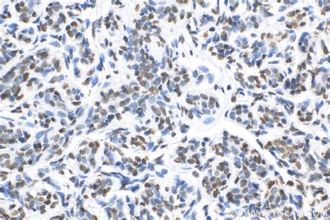 Histone H3 antibody (17168-1-AP) | Proteintech