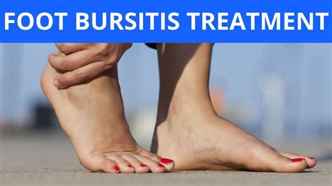 Foot Bursitis Treatment - YouTube