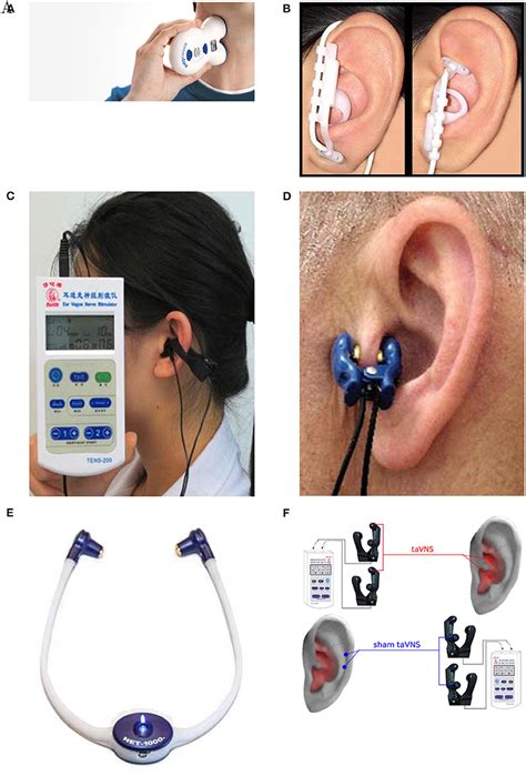 Best Vagus Nerve Stimulation Device Uk | wordpress-331561-1541677.cloudwaysapps.com