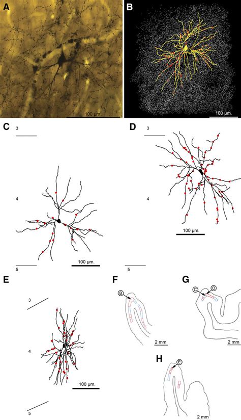 Spiny stellate cells. A, Light micrograph of spiny stellate cell... | Download Scientific Diagram