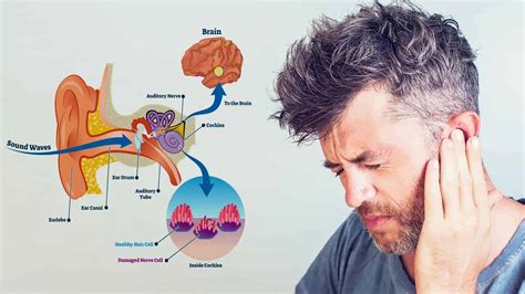 15 Causes of Ringing in the Ears (And How to Fix It)