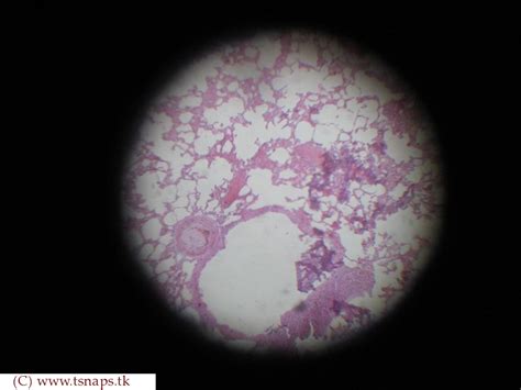 Histology Slides Database: simple squamous epithelium lung histology slide