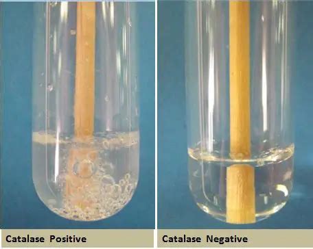 Catalase test: Principle, Procedure, Results, Uses • Microbe Online