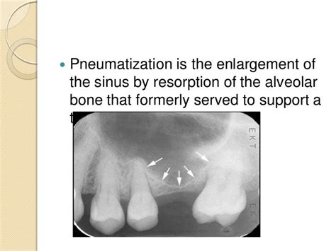 Nasal cavity and paranasal sinuses