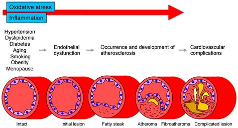 Vascular Endothelial Dysfunction-Related Disease | Encyclopedia MDPI