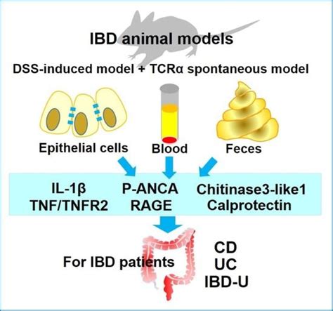 Diagnostics | Free Full-Text | A Review of Selected IBD Biomarkers: From Animal Models to Bedside