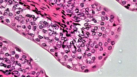 Epithelial Tissues: Transitional | cross section: urinary bl… | Flickr