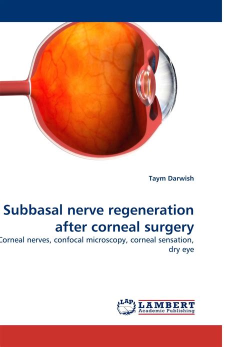 Buy Subbasal nerve regeneration after corneal surgery: Corneal nerves, confocal microscopy ...