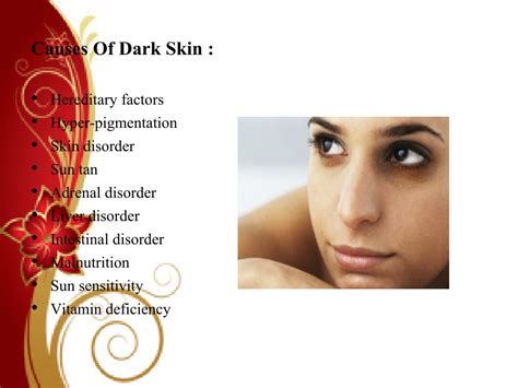 PPT - Causes of Skin Darkening PowerPoint Presentation, free download - ID:1314921