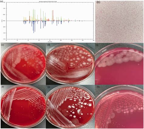 Kerstersia gyiorum isolated for the first time from two patients with neurodegenerative disease ...