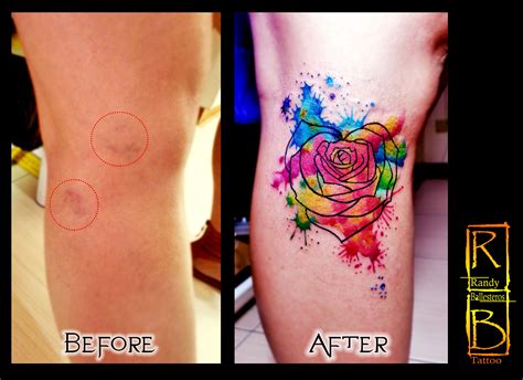 The Best Cover Up Makeup For Varicose Veins - Mugeek Vidalondon