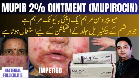 Mupir Ointment Review | Mupirocin Ointment Lp Uses Side Effects - YouTube