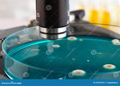 Detail Of Petri Dish In The Laboratory Microscope Stock Image - Image of examination, background ...