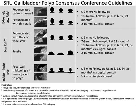 Gallbladder Polyp Guidelines – SRU | UW MEDICINE ULTRASOUND