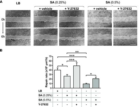 ROCK inhibitor Y-27632 prevented the deleterious effect of S aureus ...