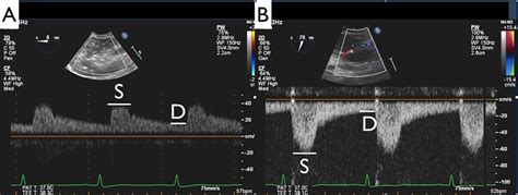 How to Perform Renal Blood Flow Measurements | Duke Department of ...