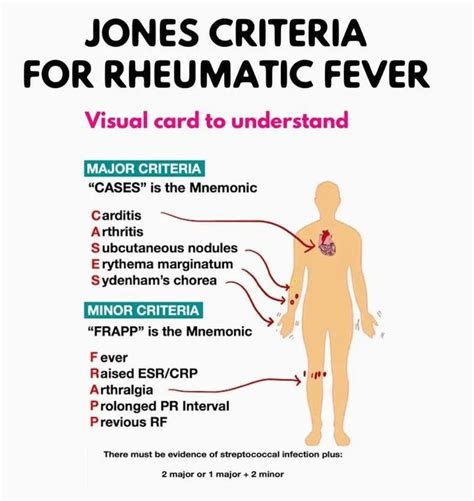 Jones Criteria - MEDizzy