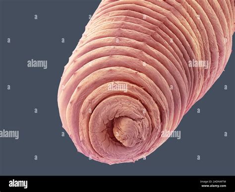 Earthworm (Lumbricus terrestris), coloured scanning electron micrograph (SEM). Its segmented ...