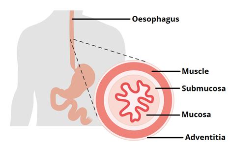 They will make the esophagus from the thigh tissues - Healthy Food Near Me