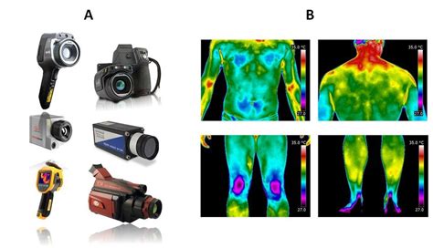 1. (A) Example of different thermographic cameras and (B) body ...