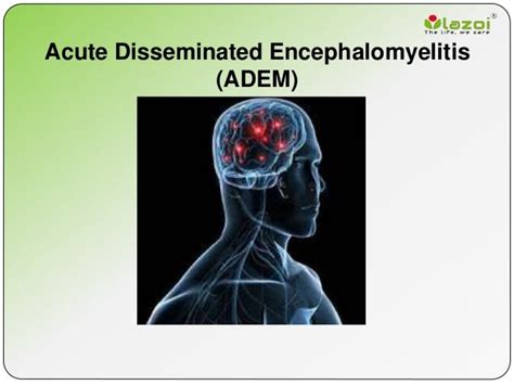 Acute disseminated encephalomyelitis