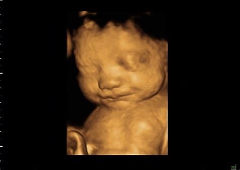 32 weeks Baby in 3D 4D scan Ultrasound | 32 weeks baby image… | Flickr