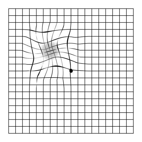 Amsler grid: Macular degeneration test at home | Lentiamo