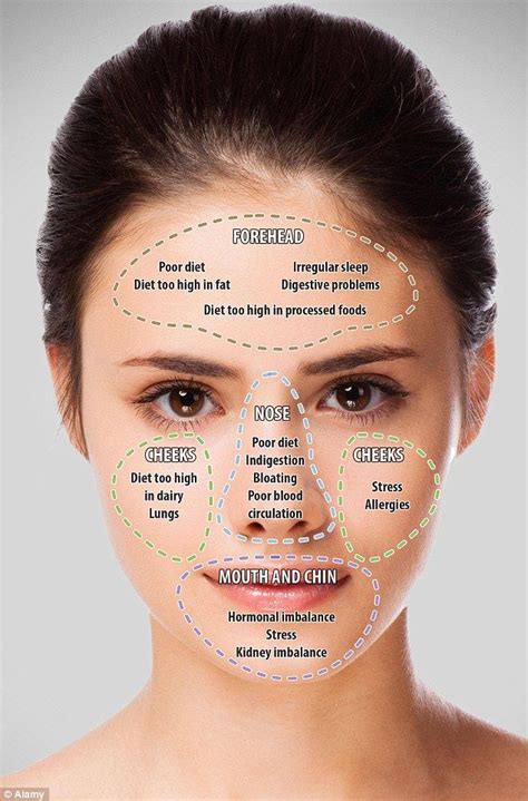 Face mapping your acne and what it means on your face revealed | Face mapping acne, Face acne ...