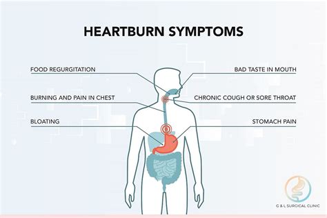 Heartburn and upper chest discomfort - jadepilot