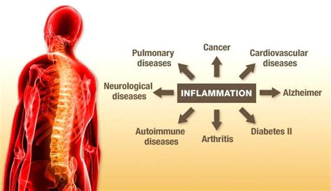 14 Natural Anti Inflammatory Foods