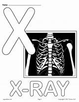 x ray Printable coloring Pages Alphabet  sketch template