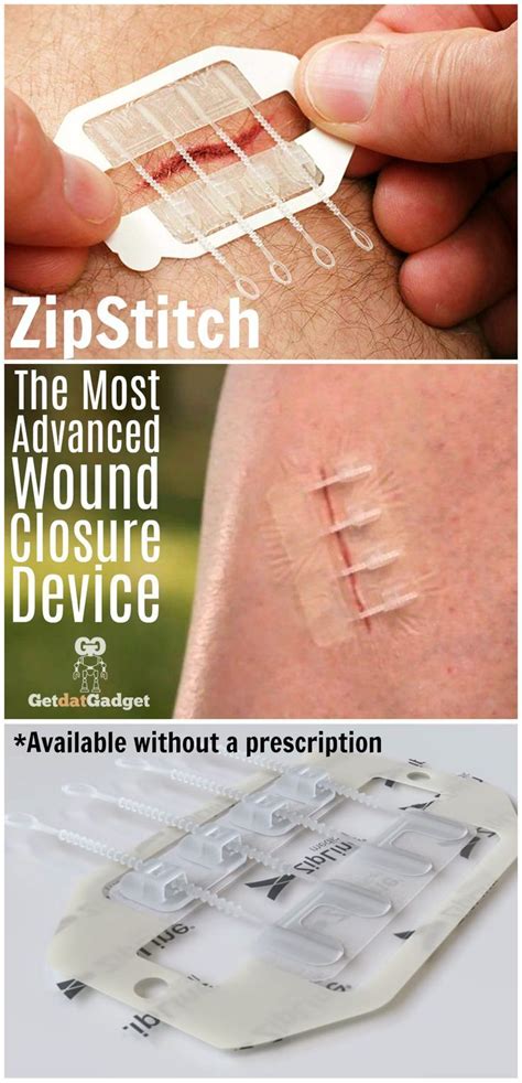 Zipstitch Closes Wounds Without Stitches - GetdatGadget | Emergency preparation, Survival skills ...