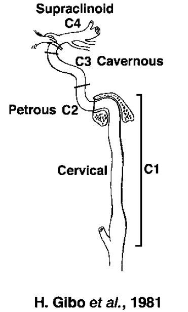 Dr Balaji Anvekar FRCR: Internal carotid artery Anatomy