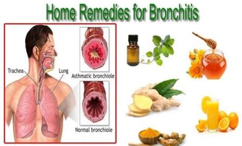 Natural remedies for bronchitis - Philadelphia Holistic Clinic - Dr. Tsan & Co