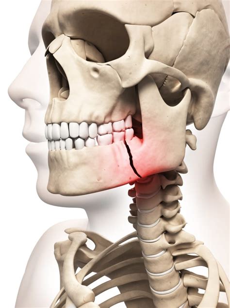 FACIAL TRAUMA - Aspen Oral and Facial Surgery