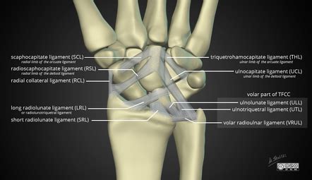 Wrist ligaments | Radiology Reference Article | Radiopaedia.org