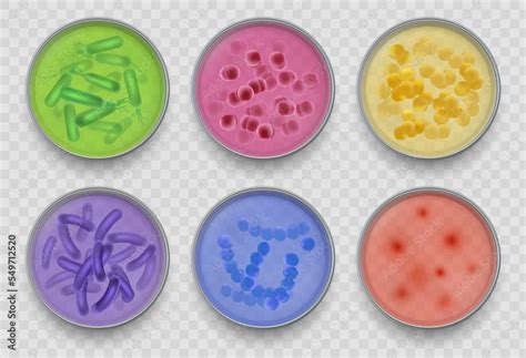 Bacteria gram. Various microorganism top views in petri dish bacteriology laboratory experiments ...