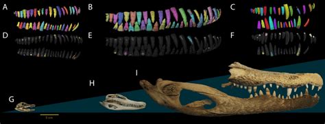 Dental anatomy of Alligator used in this study. (A, D, G) NCSM 100803;... | Download Scientific ...