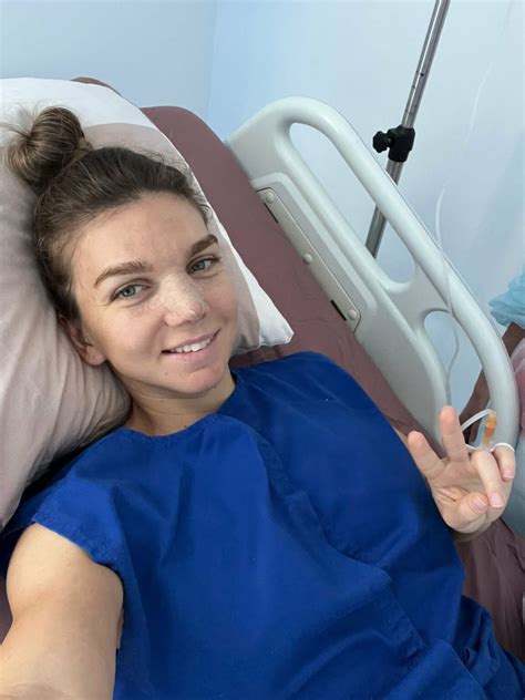 Simona Halep nose job - Everything you need to know about the former world no.1 star's surgery