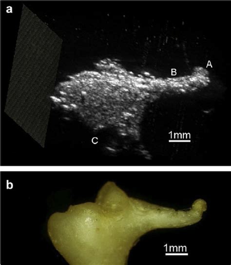 (a) 50 MHz ultrasound image of the Incus and (b) photograph of the ...