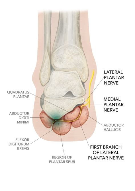 Sports Injury Bulletin - Ankle and foot injuries - Baxter's Nerve Entrapment: When Feet Throw a ...