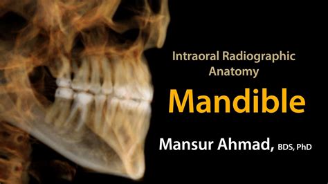 Intraoral Anatomy