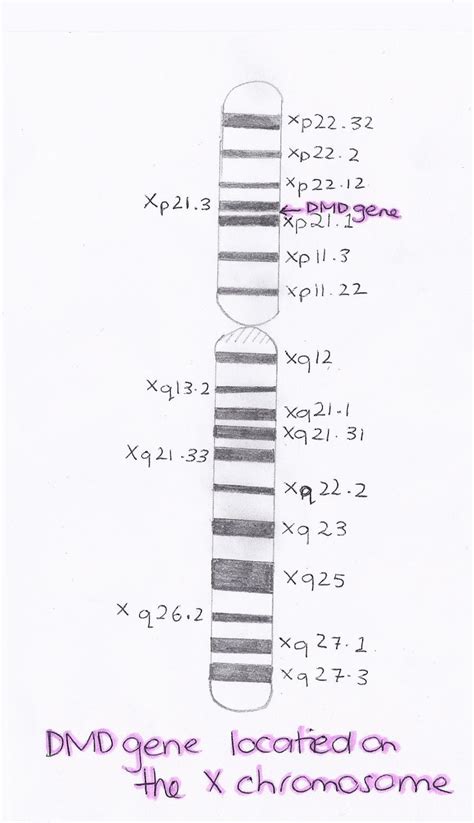 File:X chromosome location of the dystrophin gene.jpg - Embryology