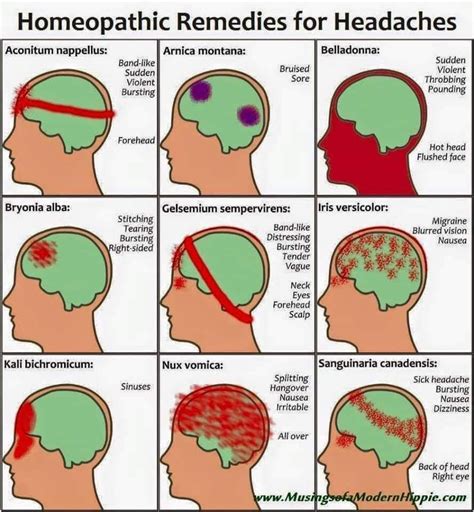 Types Of Headaches Migraines Remedies - vrogue.co