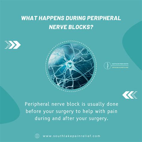 Peripheral Nerve Blocks: Benefits and Procedure – South Lake Pain ...