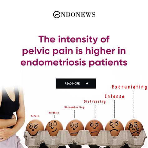 The intensity of pelvic pain is higher in endometriosis patients | EndoNews