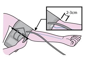 How to Position the Blood Pressure Monitor Cuff?